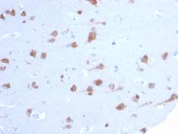 IHC staining of FFPE human brain tissue with RBFOX3 antibody (clone NEUN/7167). HIER: boil tissue sections in pH 9 10mM Tris with 1mM EDTA for 20 min and allow to cool before testing.~