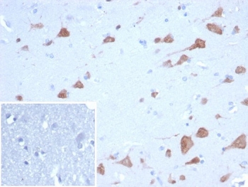 IHC staining of FFPE human brain tissue with RBFOX3 antibody (clone NEUN/7168). Inset: PBS used in place of primary Ab (secondary Ab negative control). HIER: boil tissue sections in pH 9 10mM Tris with 1mM EDTA for 20 min and allow to cool before testing.~