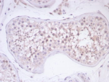 IHC staining of FFPE human testis tissue with Survivin antibody (clone BIRC5/7778). HIER: boil tissue sections in pH 9 10mM Tris with 1mM EDTA for 20 min and allow to cool before testing.~