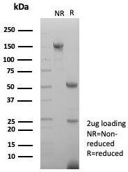 SDS-PAGE analysis of purified, BSA-free Survivin a