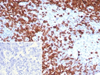 IHC staining of FFPE human lymph node tissue with CD7 ant