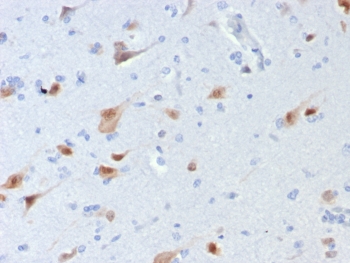 IHC staining of FFPE human brain tissue with NeuN antibody (clone rNEUN/8054). HIER: boil tissue sections in pH 9 10mM Tris with 1mM EDTA for 20 min and allow to cool before testing.~