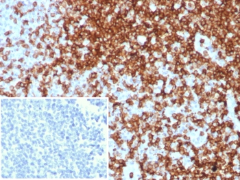IHC staining of FFPE human tonsil tissue wit