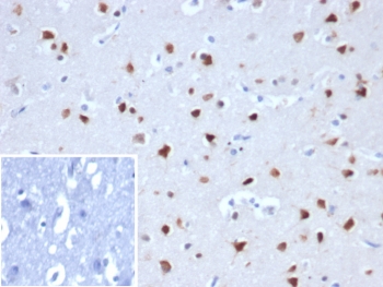 IHC staining of FFPE human cerebellum tissue with RBFOX3antibody (clone NEUN/8096R). Inset: PBS used in place of primary Ab (secondary Ab negative control). HIER: boil tissue sections in pH 9 10mM Tris with 1mM EDTA for 20 min and allow to cool before testing.~