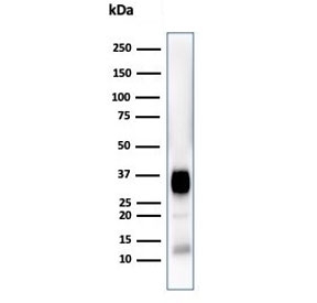 Western blot testing of human Jurkat cell lysate with CD7 antibody (clone CD7/3868R). Expected molecular weight: 25-40 kDa depending on glycosylation level.~