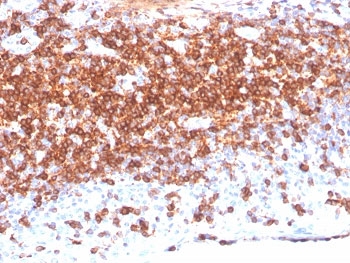 IHC staining of FFPE human lymph node tissue with CD7 antibody (clone CD7/3868R).