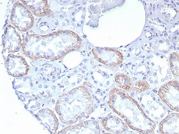 IHC staining of FFPE human kidney tissue with recombinant CDH2 antibody (clone rCDH2/8291). HIER: boil tissue sections in pH 9 10mM Tris with 1mM EDTA for 20 min and allow to cool before testing.~
