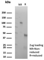 SDS-PAGE analysis of purified, BSA-free NCAD antibody (