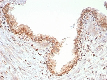 IHC staining of FFPE human prostate tissue with SMAD4 antibody (clone SMAD4/7903). HIER: boil tissue sections in pH 9 10mM Tris with 1mM EDTA for 20 min and allow to cool before testing.~