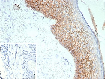 IHC staining of FFPE human skin tissue with DSG3 antibody (clone rDSG3/8611). Inset: PBS used in place of primary Ab (secondary Ab negative control). HIER: boil tissue sections in pH 9 10mM Tris with 1mM EDTA for 20 min and allow to cool before testing.~