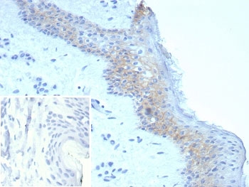 IHC staining of FFPE human skin tissue with Desmoglein 3 antibody (clone DSG3/8251R). Inset: PBS used in place of primary Ab (secondary Ab negative control). HIER: boil tissue sections in pH 9 10mM Tris with 1mM EDTA for 20 min and allow to cool before testing.~