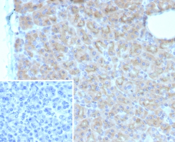 IHC staining of FFPE human pancreas tissue with SMA