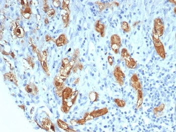 IHC staining of FFPE human lung tissue with SERPI