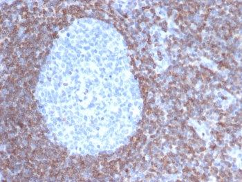 IHC staining of FFPE human tonsil tissue with Bcl-2 antibody (clone BCL2/6915). HIER: boil tissue sections in pH 9 10mM Tris with 1mM EDTA for 20 min and allow to cool before testing.~