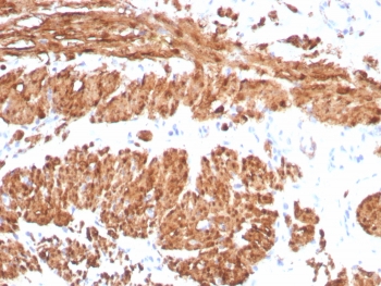 IHC staining of FFPE human smooth muscle tissue with Calponin antibody (clone CNN1/8870R). HIER: boil tissue sections in pH 9 10mM Tris with 1mM EDTA for 20 min and allow to cool before testing.