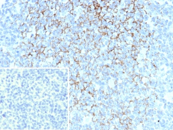 IHC staining of FFPE human tonsil. Membrane stained using FCER2/6893 at 2ug/ml. Inset: PBS used in place of primary Ab (secondary Ab negative control). HIER: boil tissue sections in pH 9 10mM Tris with 1mM EDTA for 20 min and allow to cool before testing.~
