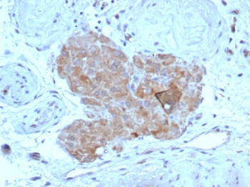 IHC staining of FFPE human testis tissue with Anti-Mullerian Hormone antibody (clone AMH/7354). HIER: boil tissue sections in pH 9 10mM Tris with 1mM EDTA for 20 min and allow to cool before testing.~