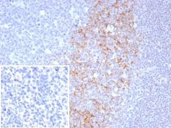 IHC staining of FFPE human tonsil tissue with CD23 antibody (clone FCER2/8511R). Inset: PBS used in place of primary Ab (secondary Ab negative control). HIER: boil tissue sections in pH 9 10mM Tris with 1mM EDTA for 20 min and allow to cool before testing.~