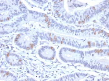 IHC staining of FFPE human colon tissue with HMG20B antibody (clone PCR