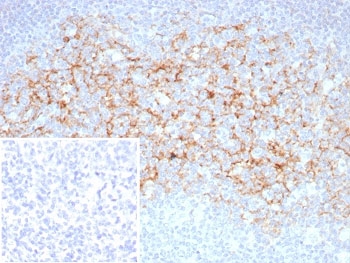 IHC staining of FFPE human tonsil tissue with CD23 antibody (clone FCER2/8510R). Inset: PBS used in place of primary Ab (secondary Ab negative control). HIER: boil tissue sections in pH 9 10mM Tris with 1mM EDTA for 20 min and allow to cool before testing.~