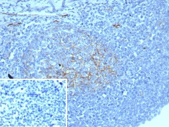 IHC staining of FFPE human tonsil tissue with recombinant CD54 antibody (clone ICAM1/8677R). Inset: PBS used in place of primary Ab (secondary Ab negative control). HIER: boil tissue sections in pH 9 10mM Tris with 1mM EDTA for 20 min and allow to cool before testing.~
