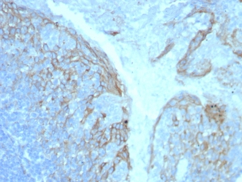 IHC staining of FFPE human tonsil tissue with CD54 / ICAM-1 antibody (clone ICAM1/8247R). HIER: boil tissue sections in pH 9 10mM Tris with 1mM EDTA for 20 min and allow to cool before testing.~
