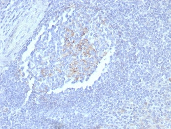 IHC staining of FFPE human tonsil tissue with CD23 antibody (clone FCER2/8235R). HIER: boil tissue sections in pH 9 10mM Tris with 1mM EDTA for 20 min and allow to cool before testing.~