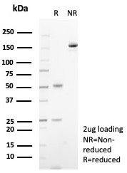 SDS-PAGE analysis of purified, BSA-free CD23 antibody (clone FCER2/8236R) as confirmation of integrity and purity.