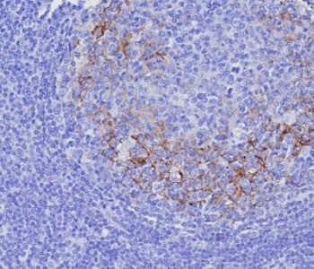 IHC staining of FFPE human tonsil tissue with CD23 antibody (clone FCER2/8237R). HIER: boil tissue sections in pH 9 10mM Tris with 1mM EDTA for 20 min and allow to cool before testing.~