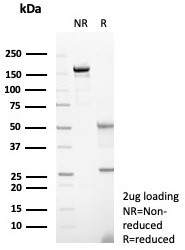 SDS-PAGE analysis of purified, BSA-free CD23 antibody
