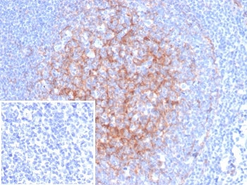 IHC staining of FFPE human tonsil tissue with ICAM-1 antibody (clone ICAM1/6968). Inset: PBS used in place of primary Ab (secondary Ab negative control). HIER: boil tissue sections in pH 9 10mM Tris with 1mM EDTA for 20 min and allow to cool before testing.~