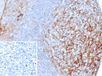 IHC staining of FFPE human tonsil tissue with ICAM-1 antibody (clone ICAM1/6606). Inset: PBS used in place of primary Ab (secondary Ab negative control). HIER: boil tissue sections in pH 9 10mM Tris with 1mM EDTA for 20 min and allow to cool before testing.~