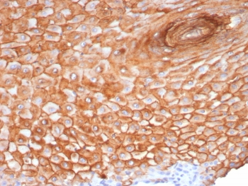 IHC staining of FFPE human skin tissue with Suprabasin antibody (clone SBSN/7965). HIER: boil tissue sections in pH 9 10mM Tris with 1mM EDTA for 20 min and allow to cool before testing.~