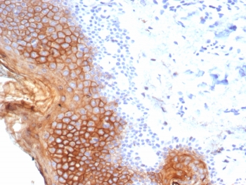 IHC staining of FFPE human esophagus tissue with Su