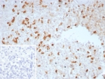 IHC staining of FFPE human spleen tissue with TGFB antibody (clone TGFB/7230). Inset: PBS used in place of primary Ab (secondary Ab negative control). HIER: boil tissue sections in pH 9 10mM Tris with 1mM EDTA for 20 min and allow to cool before testing.