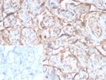 IHC staining of FFPE human placental tissue with TGF beta antibody (clone TGFB/7240). Inset: PBS used in place of primary Ab (secondary Ab negative control). HIER: boil tissue sections in pH 9 10mM Tris with 1mM EDTA for 20 min and allow to cool before testing.