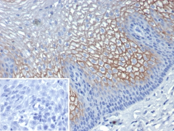 IHC staining of FFPE human esophagus tissue with SBSN antibody (clone SBSN/7961). Inset: PBS used in place of primary Ab (secondary Ab negative control). HIER: boil tissue sections in pH 9 10mM Tris with 1mM EDTA for 20 min and allow to cool before testing.~