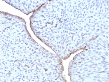 IHC staining of FFPE human bladder tissue wi