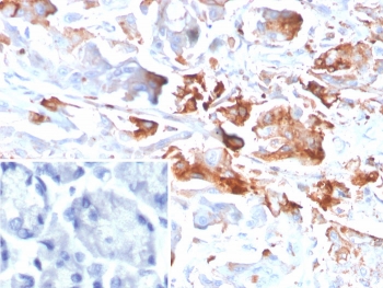 IHC staining of FFPE human stomach tissue with C