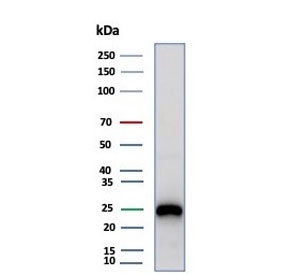 Western blot testing of human Daudi cell lysate with CD79a antibody (clone rIGA/6986). Expected molecular weight: 25-47 kDa depending on glycosylation level.~