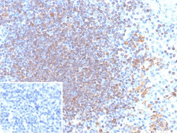 IHC staining of FFPE human tonsil tissue with CD79a antibody (clone rIGA/6986).