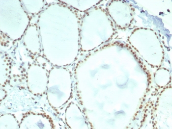 IHC staining of FFPE human thyroid tissue with ERCC1 antibody (clone ERCC1/7596). HIER: boil tissue sections in pH 9 10mM Tris with 1mM EDTA for 20 min and allow to cool before testing.~