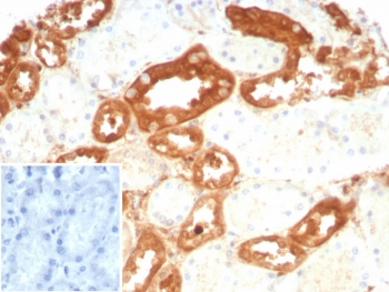 IHC staining of FFPE human kidney tissue with recombinant GSTM3 antibody (clone rGSTM3/8878). Inset: PBS used in place of primary Ab (secondary Ab negative control). HIER: boil tissue sections in pH 9 10mM Tris with 1mM EDTA for 20 min and allow to cool before testing.~