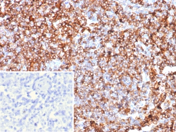 IHC staining of FFPE human lymph node tissue with Guanylate binding protein 1 antibody (clone GBP1/7617). Inset: PBS used in place of primary Ab (secondary Ab negative control). HIER: boil tissue sections in pH 9 10mM Tris with 1mM EDTA for 20 min and allow to cool before testing.~