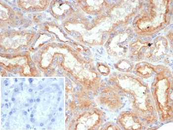 IHC staining of FFPE human kidney tissue with Ob-R antibody (clone LEPR/4545). Inset: PBS used in place of primary Ab (secondary Ab negative control). HIER: boil tissue sections in pH 9 10mM Tris with 1mM EDTA for 20 min and allow to cool before testing.~