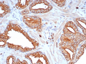 IHC staining of FFPE human prostate tissue with L1TD1 antibody (clone L1TD1/7941). HIER: boil tissue sections in pH 9 10mM Tris with 1mM EDTA for 20 min and allow to cool before testing.~