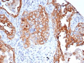 IHC staining of FFPE human lung tissue with L1TD1 a