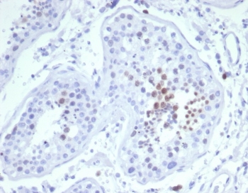 IHC staining of FFPE human testis tissue with Mitotic centromere associated kinesin antibody (clone KIF2C/6523) at 2ug/ml. HIER: boil tissue sections in pH 9 10mM Tris with 1mM EDTA for 20 min and allow to cool before testing.~