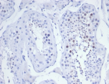 IHC staining of FFPE human testis tissue with KIF2C antibody (clone KIF2C/6525) at 2ug/ml. HIER: boil tissue sections in pH 9 10mM Tris with 1mM EDTA for 20 min and allow to cool before testing.~