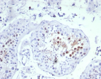 IHC staining of FFPE human testis tissue with KNSL6 antibody (clone KIF2C/6529) at 2ug/ml. HIER: boil tissue sections in pH 9 10mM Tris with 1mM EDTA for 20 min and allow to cool before testing.~